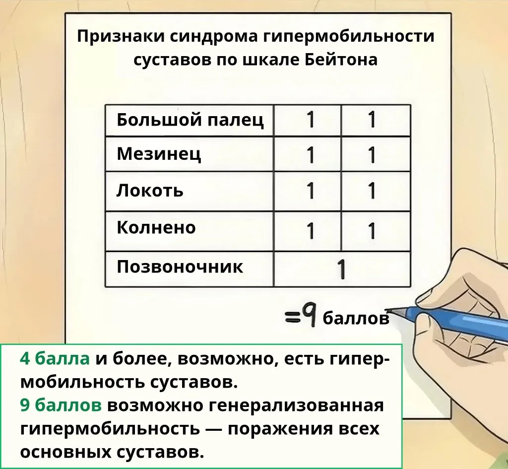 Шкала Бейтона для оценки гипермобильности суставов