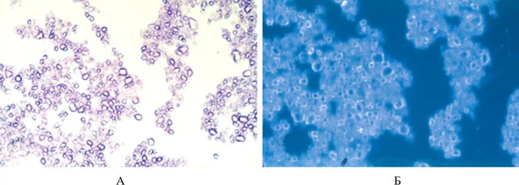basic calcium phosphate crystals.png