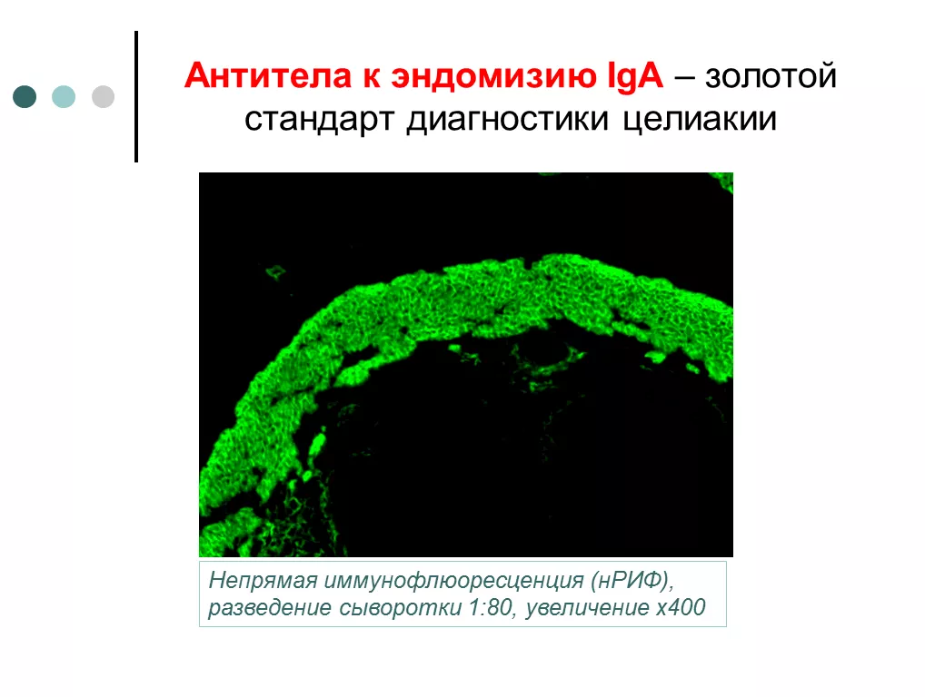 Золотой стандарт диагностики целиакии 1.png