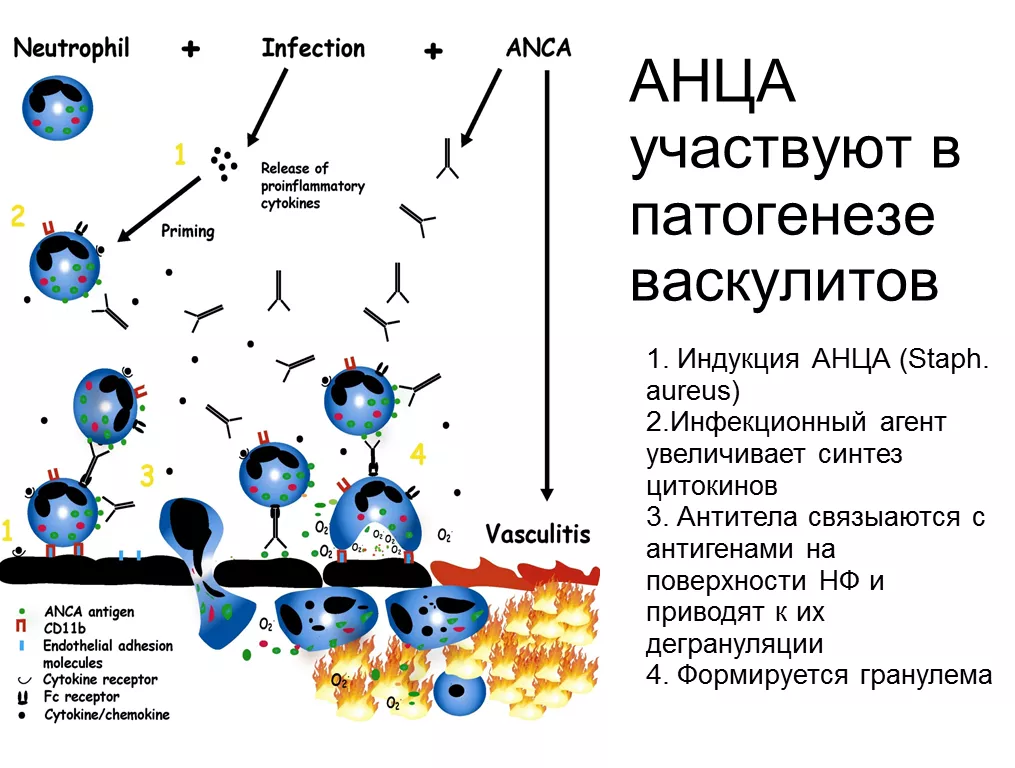 ANCA and vasculitis pathogenesis.png