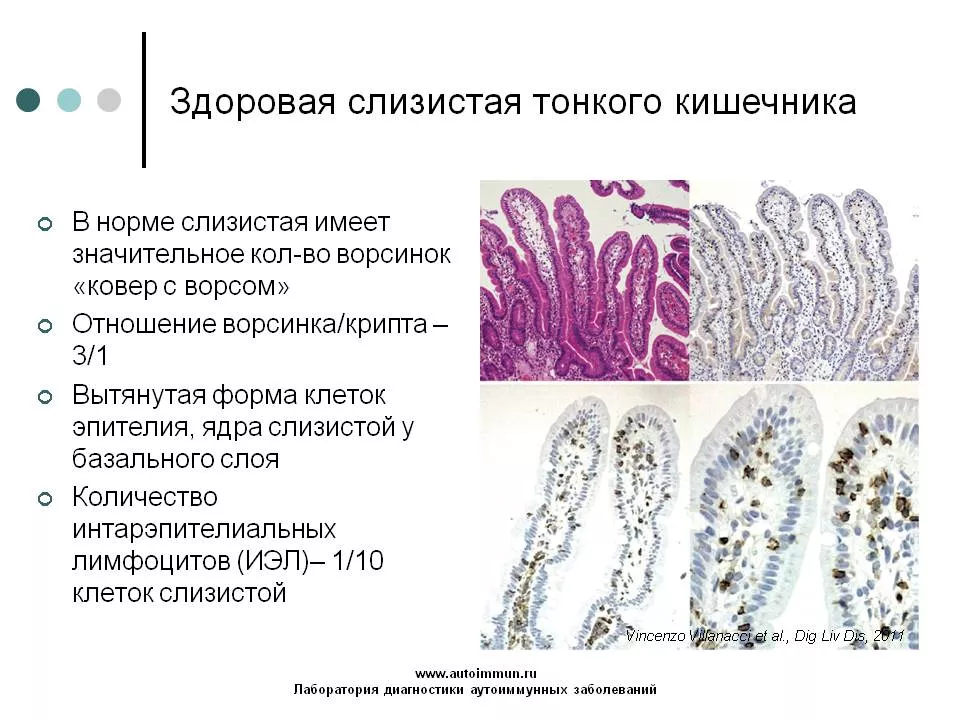 Здоровая слизистая тонкого кишечника