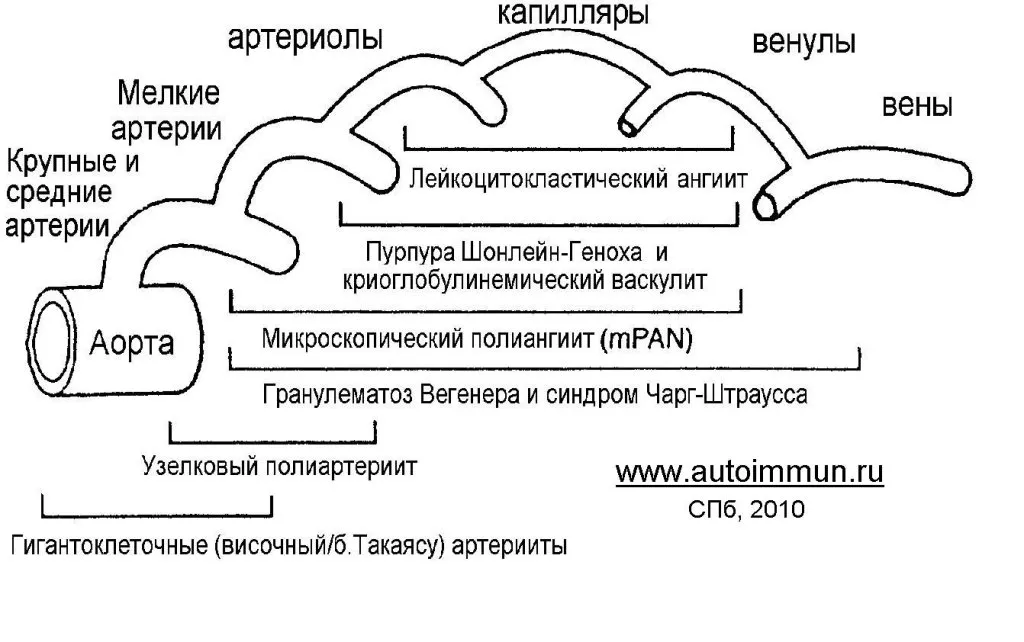 chillvasculitis_(1).jpg